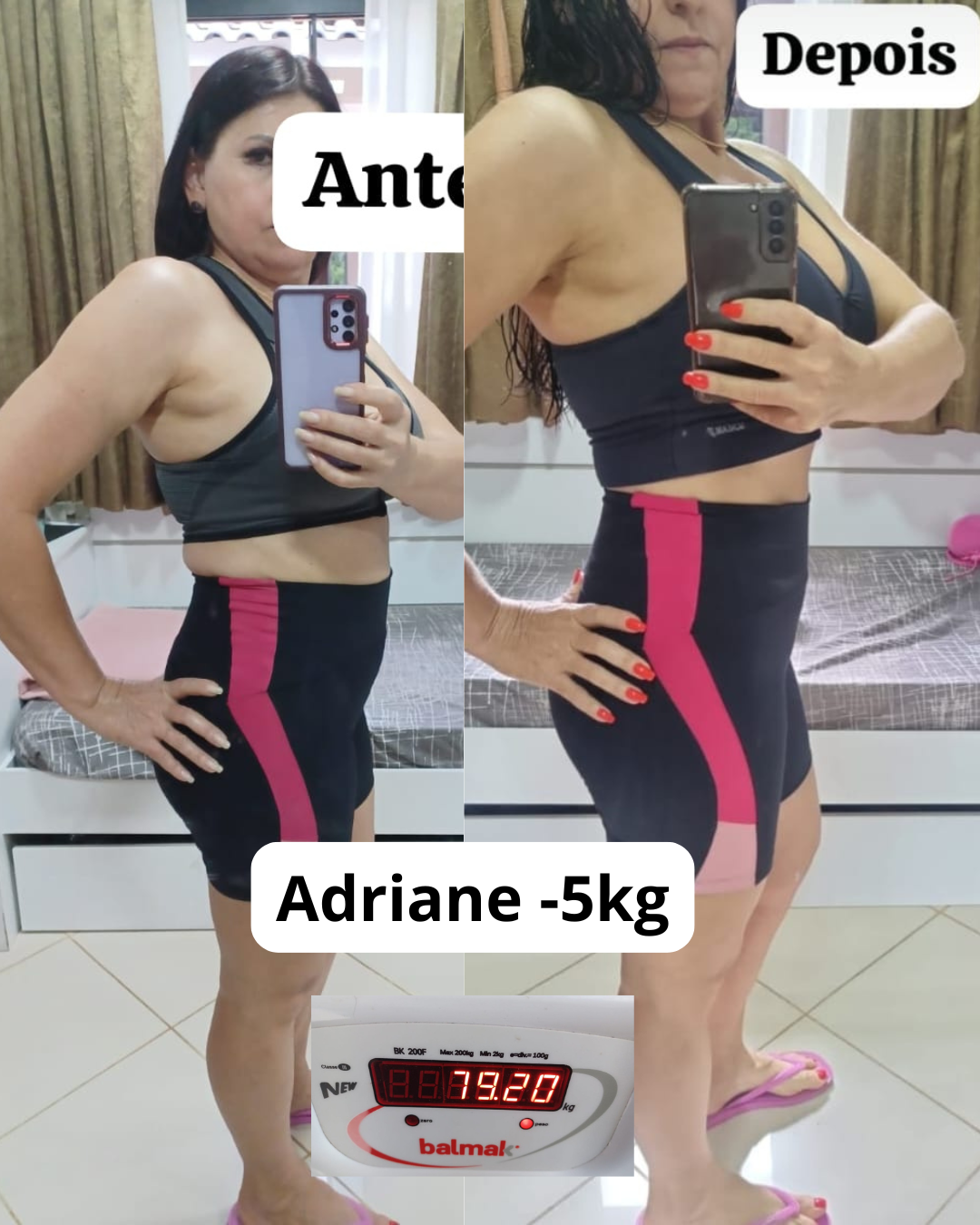 Antes e depois de Adriane