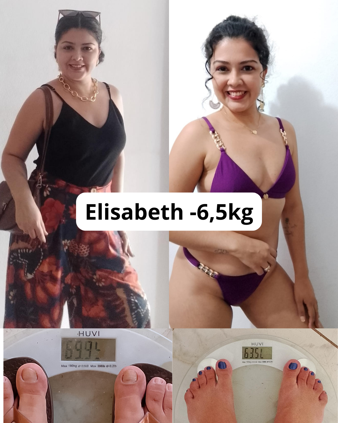 Antes e depois de Elisabeth